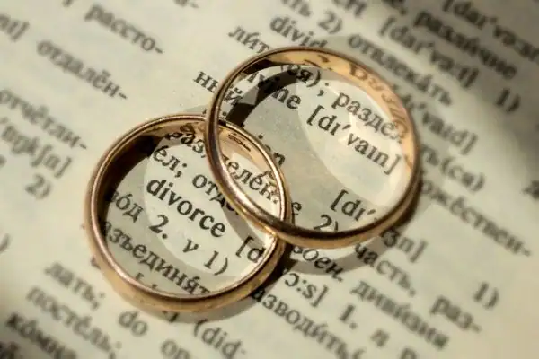 Image of rings removed before divorce mediation Hemel Hempstead